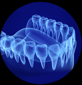 3D Smile Design